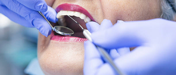 Best Emergency Dental Extractions in Iola, WI